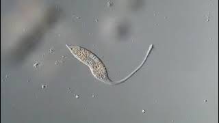 Lacrymaria - a single cell without a brain or a nervous system Profile