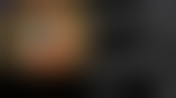 Role of Live Intraoperative OCT in DMEK    Phaco + PC IOL + DMEK