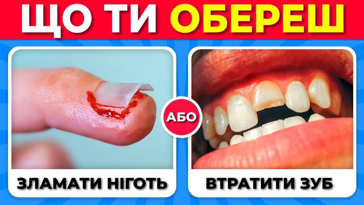 Що б ти обрав...? 50 НАЙСКЛАДНІШИХ ВИБОРІВ! ⚡🤯🎯 Вікторина українською