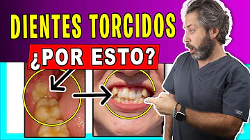 ¿Se apiñan más los dientes con la edad?