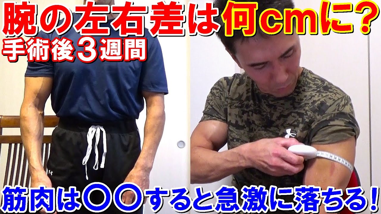 手術後3週間で腕周りは何cm細くなった？筋肉が急激に落ちたのは〇〇が原因【腱板断裂】
