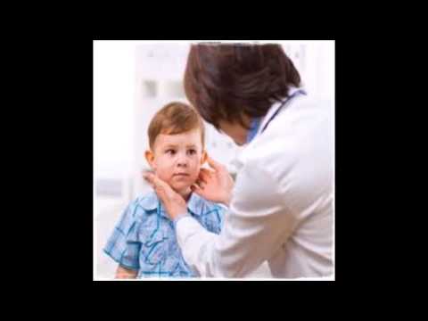 Vídeo: Linfadenitis Cervical En Niños, Adultos: Causas, Tratamiento