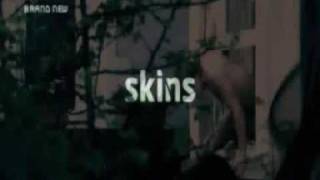 skins Openings Series 1