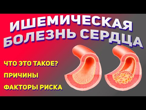 Что такое ИБС, причины ишемической болезни сердца. Факторы риска.