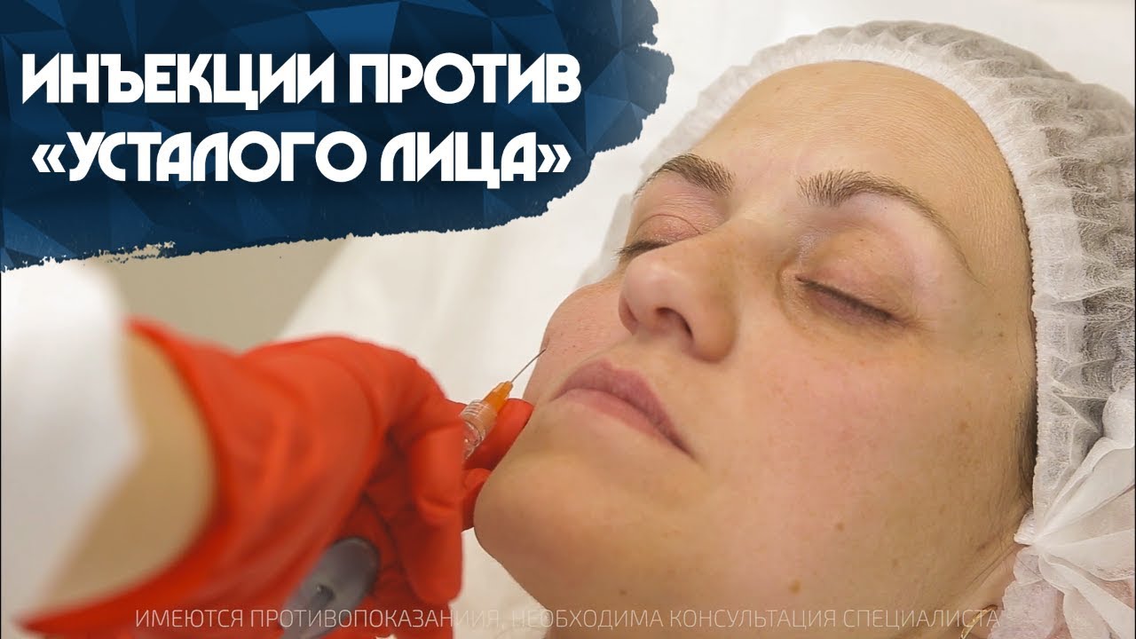 Контурная пластика. Инъекции против «усталого лица»