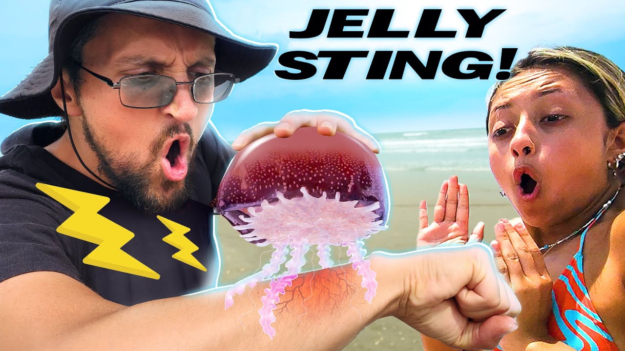 Stinging myself with Jellyfish to get Family Reactions (PRANK)