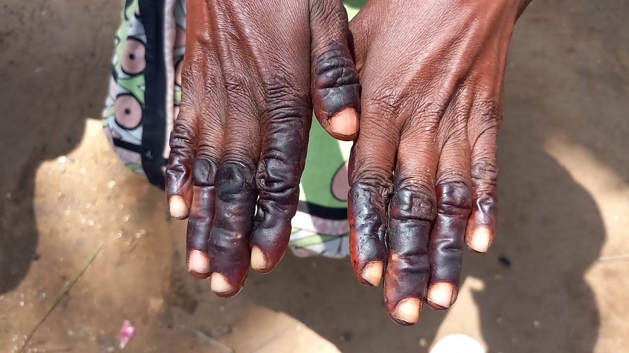 Challenges facing the casual workers in the cashew nut processing