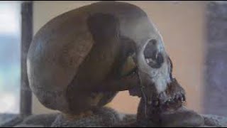 FUVU LA MKWAWA na MAAJABU YAKE.