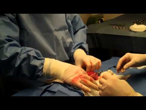 Canine Gastrotomy, Surgical Removal of Foreign Body From Stomach