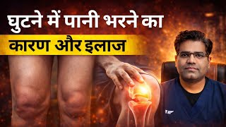 Cause and treatment of fluid accumulation in the knee | Knee Joint (synovial fluid) Swelling and ...