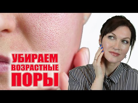 Стянем Расширенные Поры! Причина И Решения. Лучшие Средства.