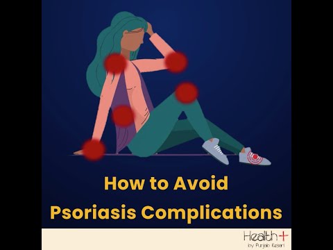 How to Avoid Psoriasis Complications