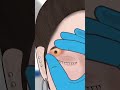 عملية إزالة القيح Shorts Asmr جراحة التجميل Viralvideo دراسة طب معلومات Fyp Short المعرفة