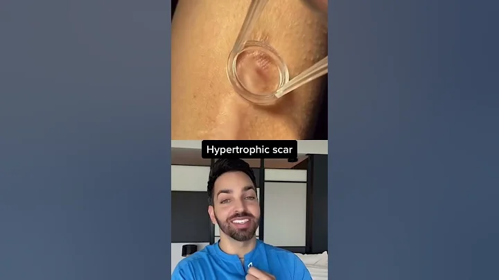 Dr. Shah Reacts to Scar Treatment #shorts - DayDayNews