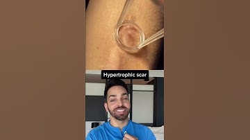 Thumbnail of Dr. Shah Reacts to Scar Treatment #shorts
