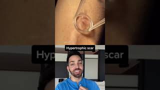 Dr. Shah Reacts to Scar Treatment #shorts