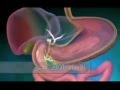 رحلة الطعام Flv 