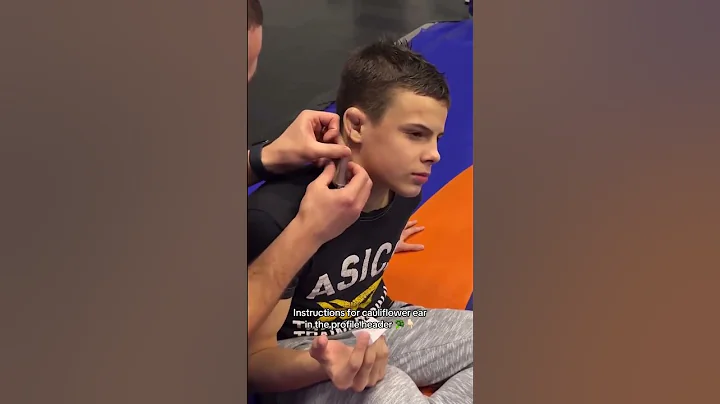 Instructions for cauliflower ear in the profile header 😳 babies view 🐣 #babiesview