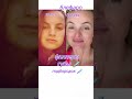 #MelAnnett #marishadeboshir #уколыкрасоты #омоложениелица #фейсфитнес #лицоуход #массажлица