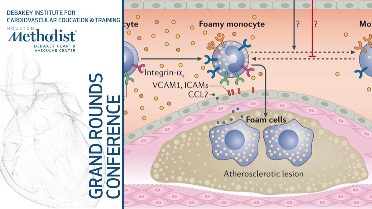 Precision Medicine for Cardiovascular Prevention (Christie M. Ballantyne, MD) June 27, 2019 surgery tech