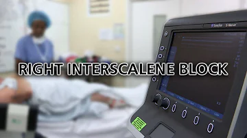 Right Interscalene Block - Dr Zahid Sheikh