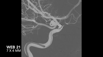 PcomA rupt WEB 21 7x4 fraai