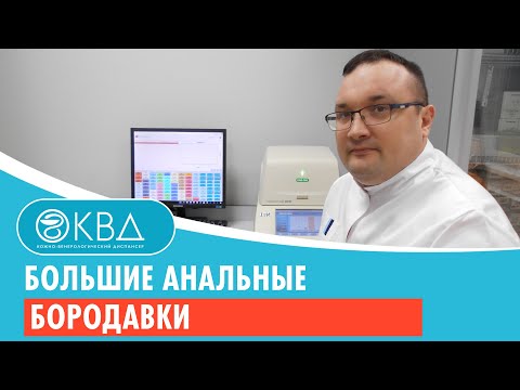 😟 Большие анальные бородавки. Клинический случай №774