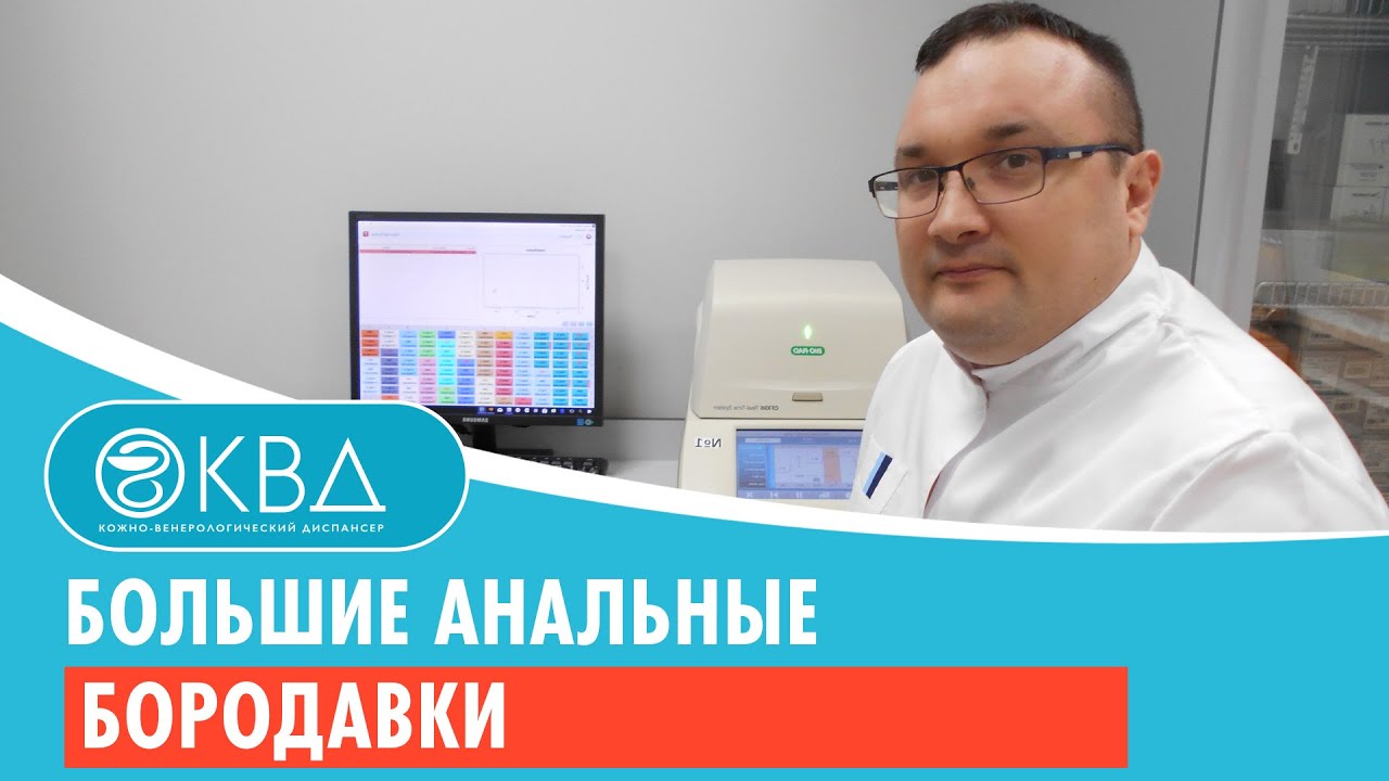😟 Большие анальные бородавки. Клинический случай №774