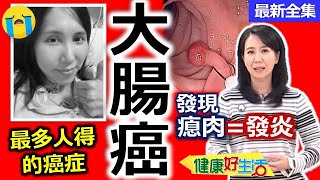 健康好生活 20220926 最多人得的癌症!病從口入「大腸癌」