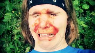 SNAKE ATTACKS FACE!!!