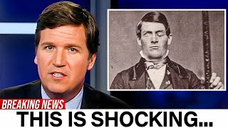 Scientists Are Still Fascnicated Phineas Gage, And Here's Why
