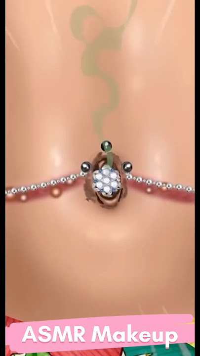 [ASMR] Remove Huge Navel stone Animation 🤮| Navel Cleaning ASMR Navel Infection Satisfying Part-3😱