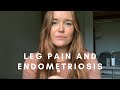 Leg pain and endometriosis  what it feels like why it happens and natural remedies to help