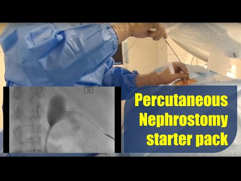 Percutaneous Nephrostomy procedure and technique: starter pack