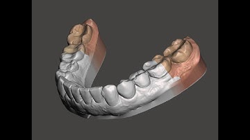 Meshmixer - Combining Scans