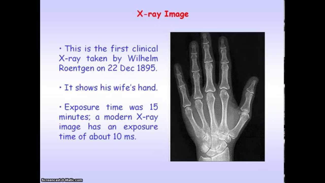 Medical Imaging 02 X Ray Imaging And Contrast Media Youtube