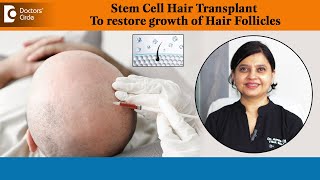 Use of Stem Cells To Reverse Baldness | Hair Regrowth Treatment - Dr. Amee Daxini | Doctors