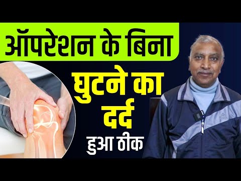 ऑपरेशन के बिना घुटने का दर्द हुआ ठीक | 100% Natural Knee Pain Relief | Karma Ayurveda Reviews