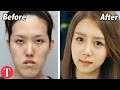 10 Shocking Facts About Korea's Billion Dollar Beauty Industry