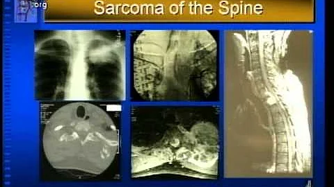 Tumors and Related Conditions