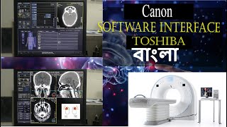 Software Interface Part -1 [Canon 160 Slice {Toshiba}] screenshot 2
