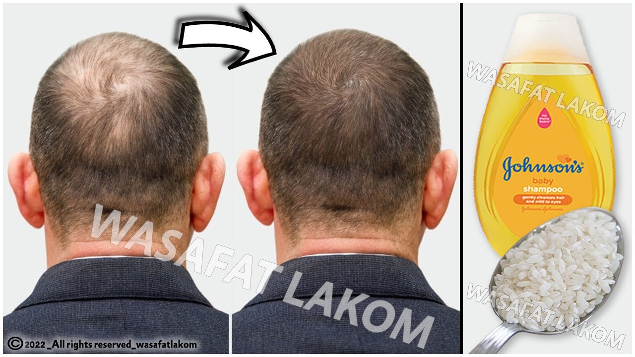 Put these ingredients in your🧴shampoo, it accelerates hair growth and