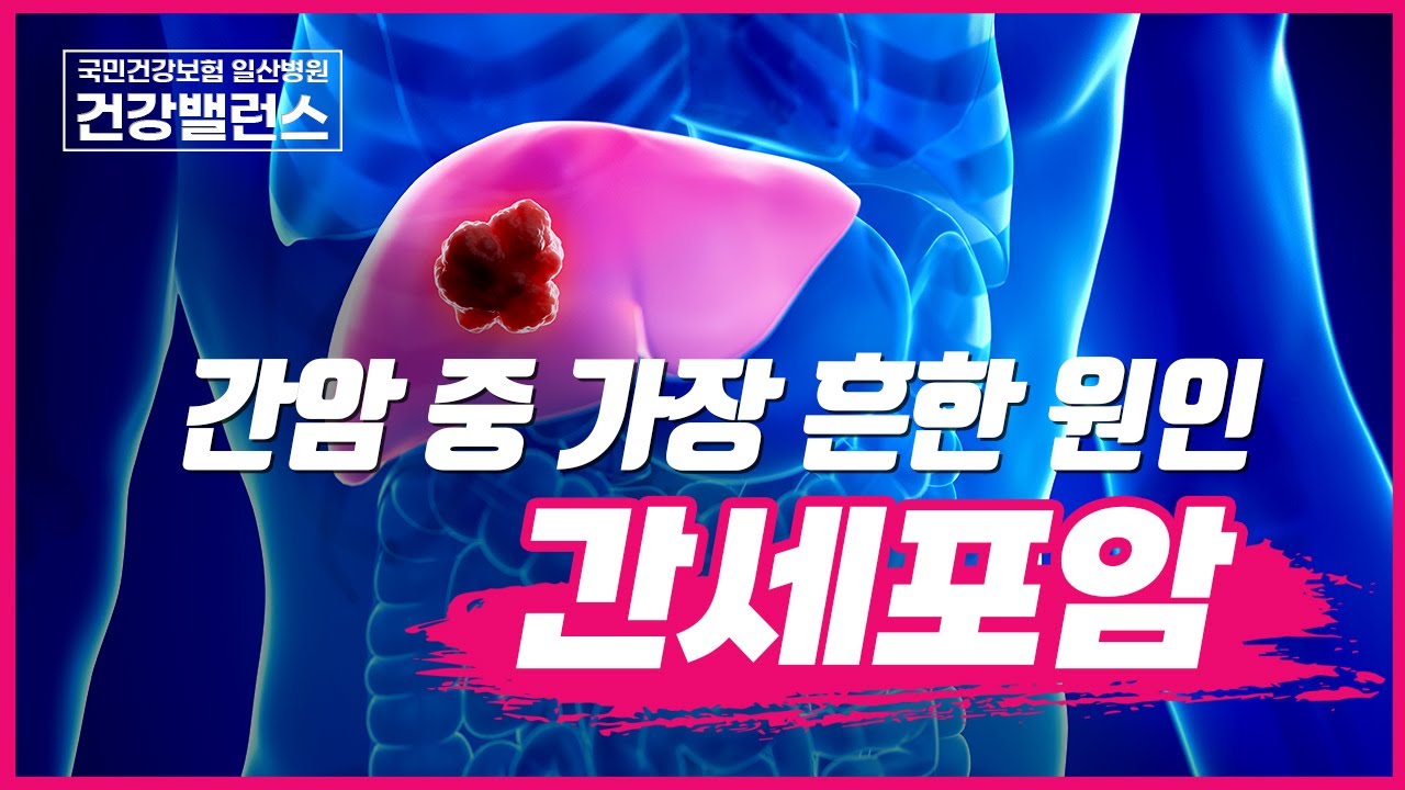 간암 중 가장 흔한 원인 간세포암!