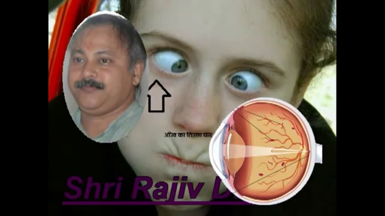 Rajiv Dixit   Treatment of weakness and slant of eyes