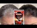 My 45 Years Sister Applied Natural Dye Once A Week &amp; Covered White Hair Naturally | White Hair Dye