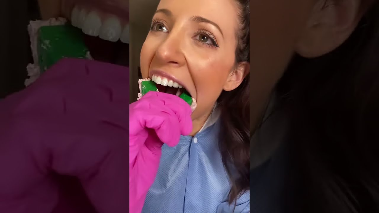 Taking My Own Teeth Impression Shorts