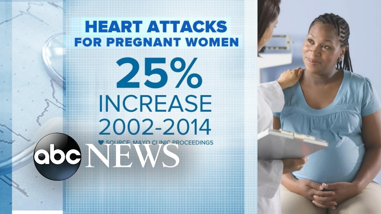 Study shows pregnant women have increased risk for heart