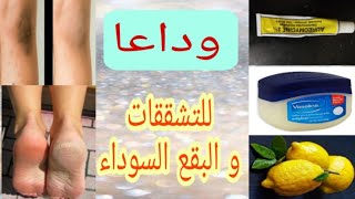 للحصول على بشرة متألقة.لامعة وضع الڤزلين قبل النوم على وجهك  كريم رائع.