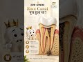 Root Canal पूरा हुआ था? अधूरा RCT दोबारा इंफेक्शन का कारण बन सकता है!