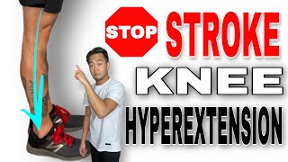 How to Fix Knee Hyperextension after a Stroke
